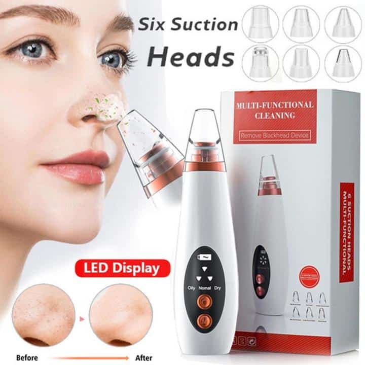 electric blackhead remover device
